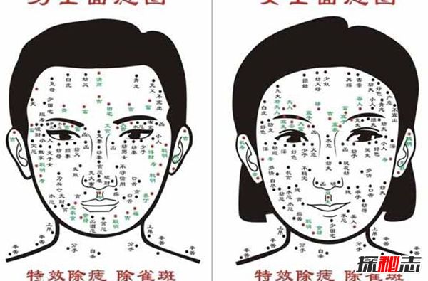 必须取的痣图片