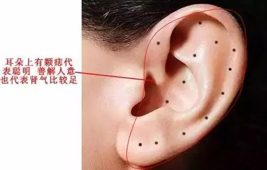 耳垂有痣的女人代表什么意思