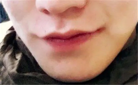 嘴唇薄的男人是不是薄情寡义