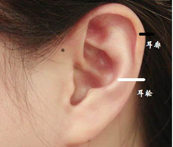 耳门有痣是儿女双全的意思吗