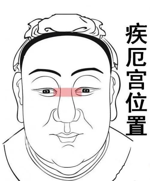 七杀入疾厄宫是什么意思