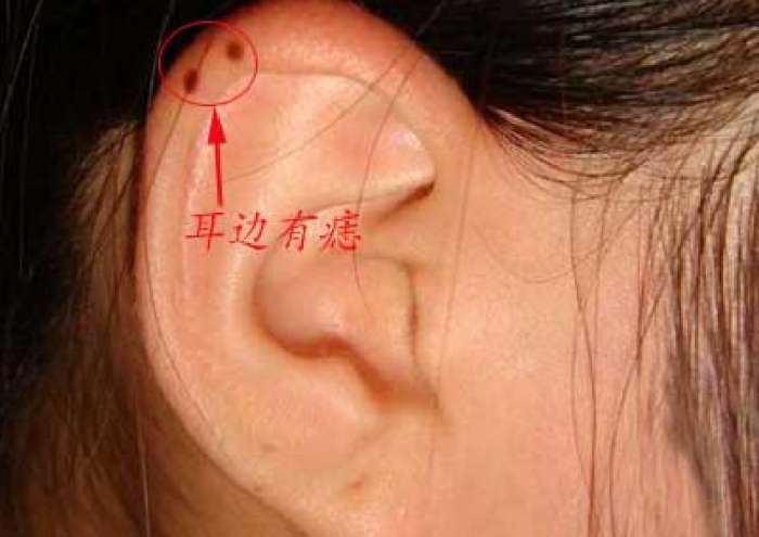 耳根有痣好不好