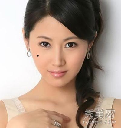 脸颊上有痣好不好