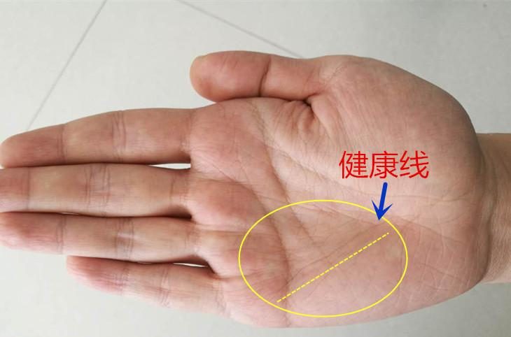 哪条是健康线