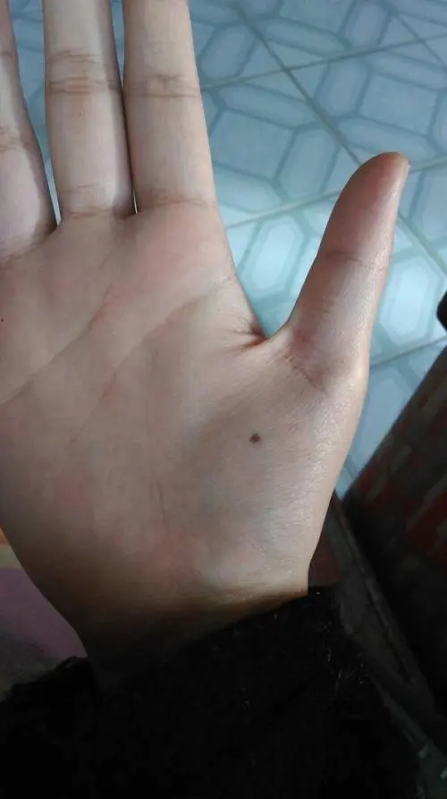 手掌有痣的女人好不好