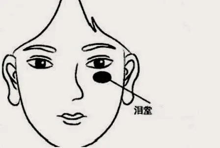泪堂痣可不可以去掉
