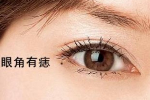 眼部有痣的人命运如何