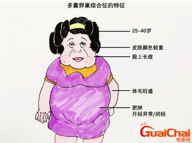多囊卵巢综合症有哪些症状？多囊卵巢综合症的危害