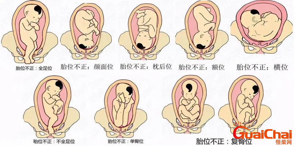 思维loa胎位是什么意思？loa胎位是什么意思图片