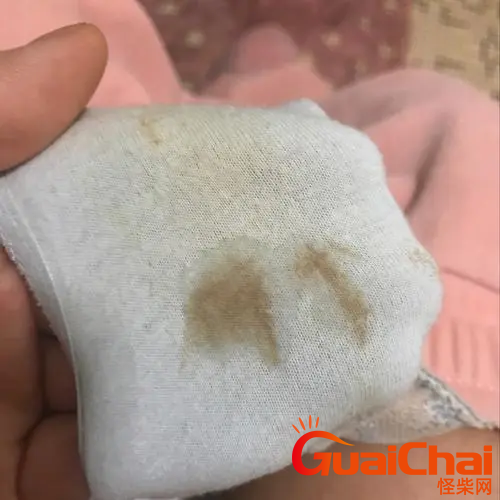 怀孕后为什么有褐色分泌物？怀孕后有褐色分泌物的原因？