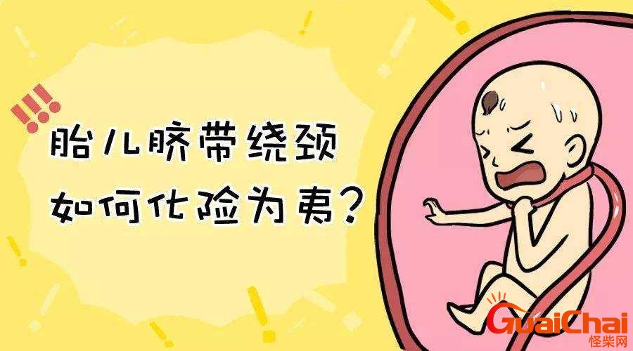 脐带绕颈一周怎么办要注意什么？脐带绕颈一周怎么办能顺产吗