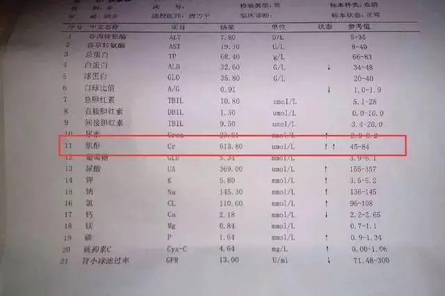 肌酐低了怎么样？肌酐低了后果是什么？