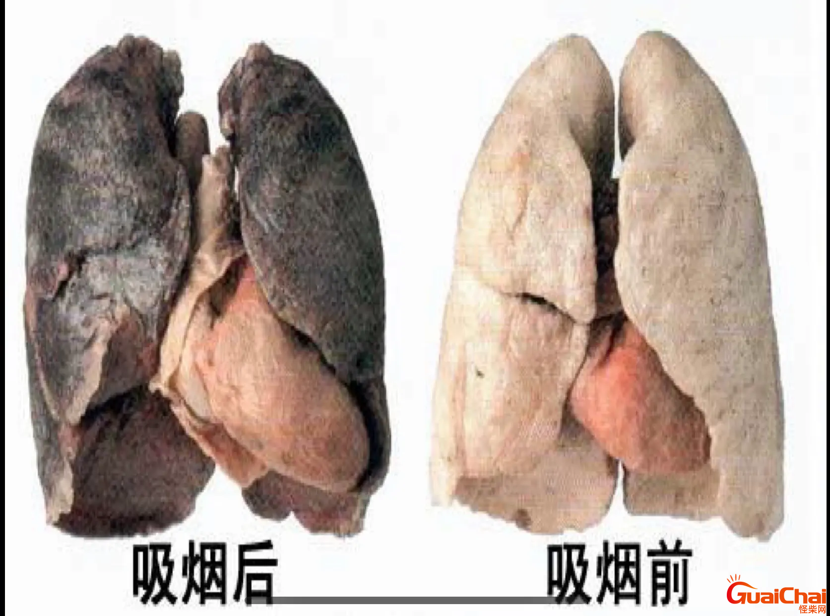 长期吸烟对身体的危害有哪些？青少年吸烟对身体的危害有哪些