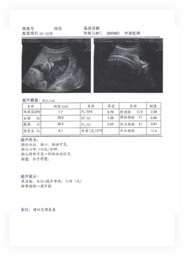 什么是胎儿超声测值？HC是啥意思？