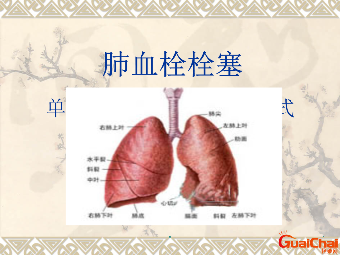 501a73c678c7ac0c52e966cad57dd77f_wKh2Altgt36IbyETABFHxKNwpWMAADaLgAX_h8AEUfc760.jpg