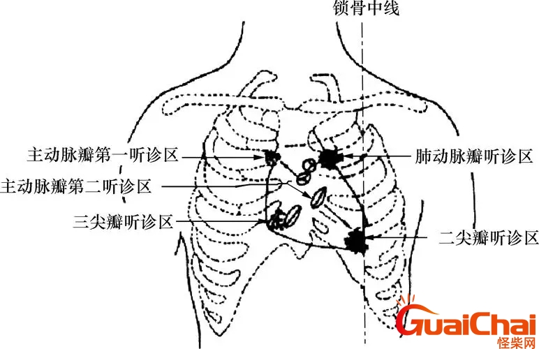 心脏听诊区位置及顺序图片 心脏听诊区位置图片