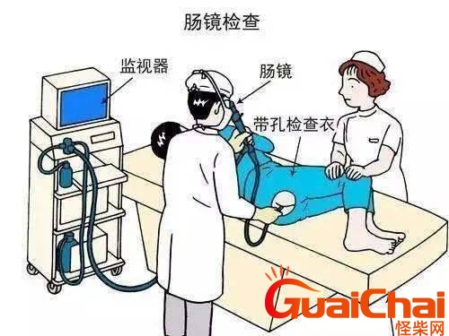 肠镜检查对身体有损伤吗？为什么不建议年轻人做肠镜和镜 