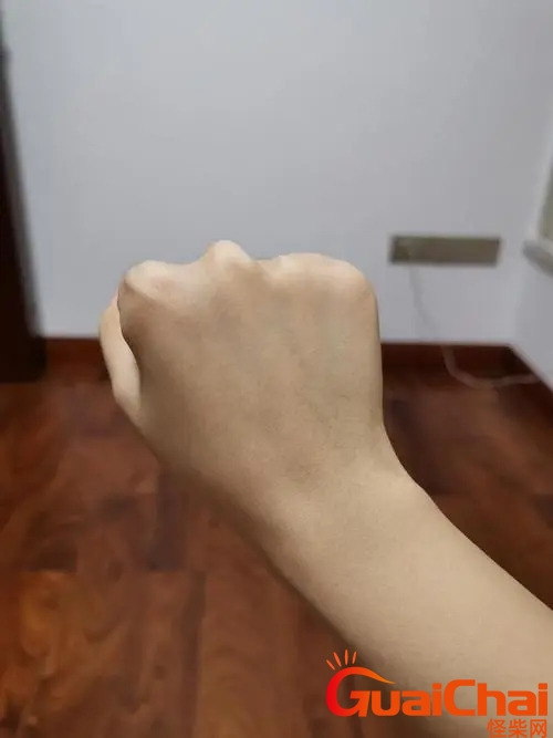橄榄皮是什么皮肤？橄榄皮有什么特征