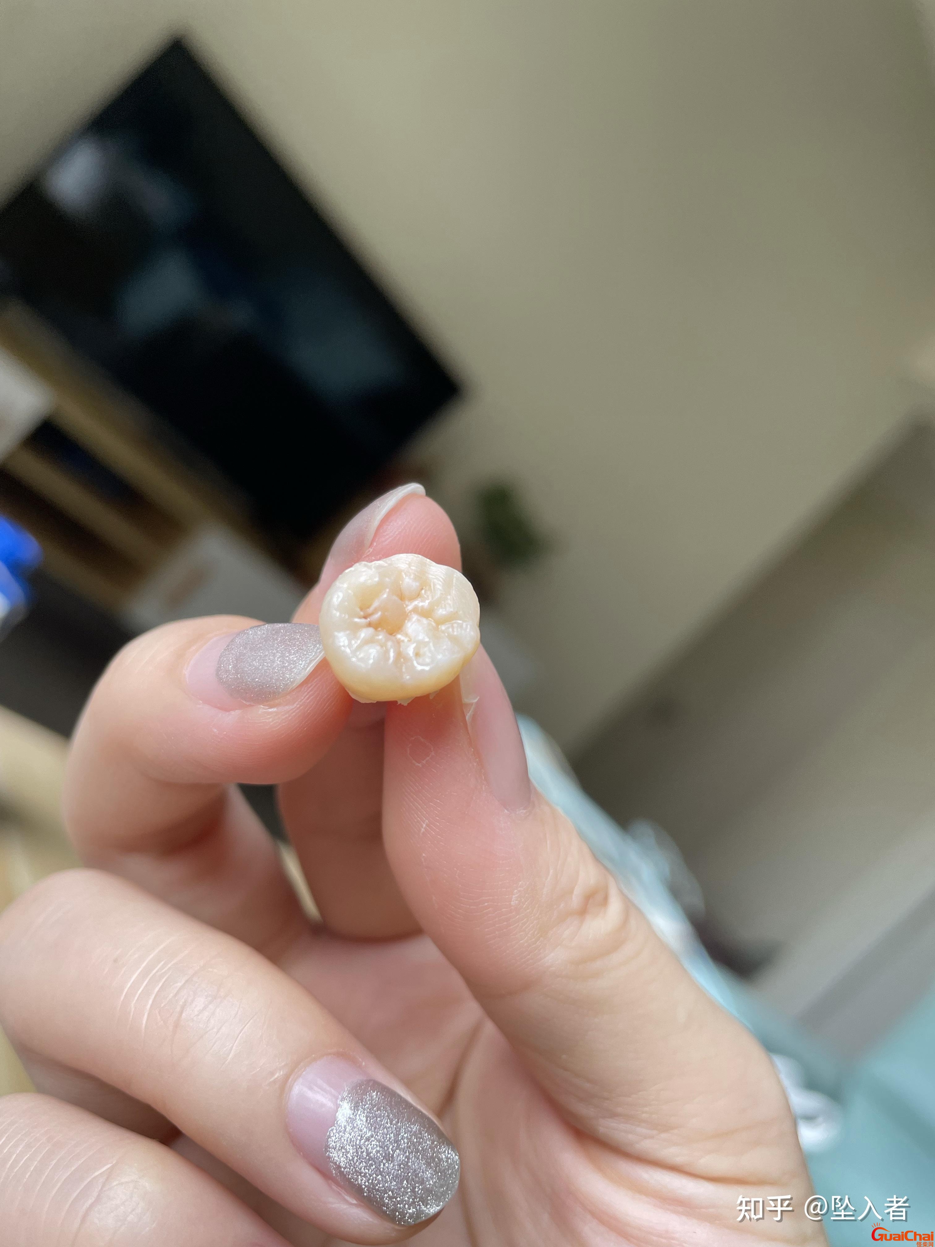 拔智齿后那个洞臭到恶心怎么解决？拔智齿后那个洞臭到恶心正常吗