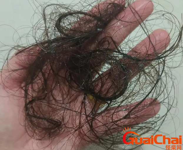 脱发应该怎么办？ 治疗脱发的药膳？